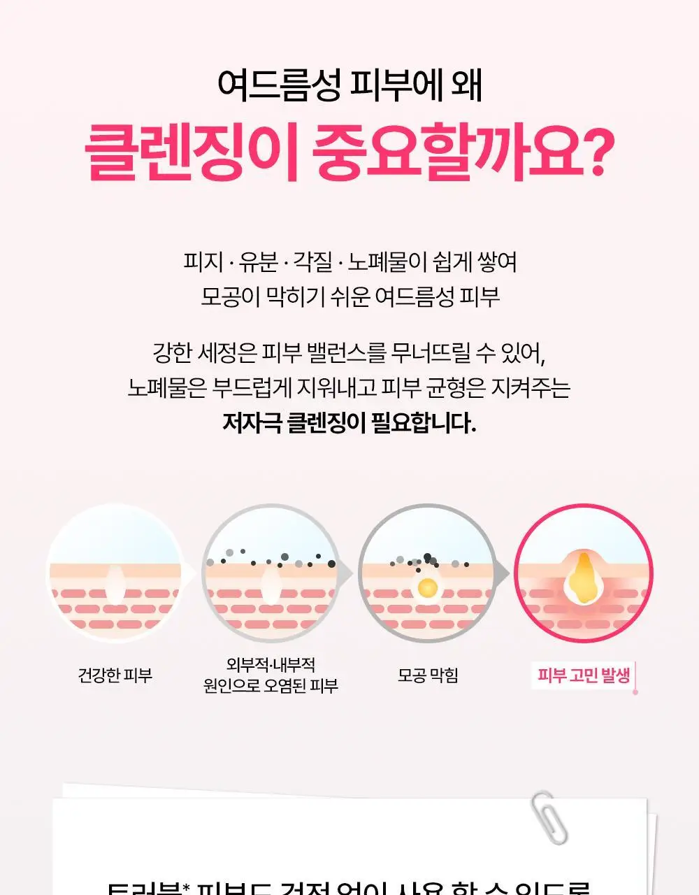 [트러블 피부 추천/여드름균 항균 클렌징] 제로이드 핌프로브 젤 클렌저 180ml 상세페이지 10